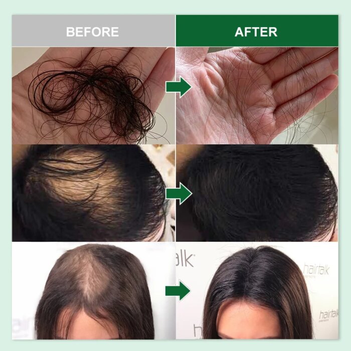 Rosemary Oil Hair Growth and Scalp Treatment Hair Care