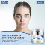 Retinol Face Cream Anti-wrinkle Anti-aging Moisturizing Hyaluronic Acid Vitamin C Facial Cream Skincare Face Whitening Creams Facial Care