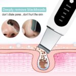 Ultrasonic Skin Scrubber Peeling Blackhead Remover Deep Face Cleaning Ultrasonic Ion Ance Pore Cleaner Facial Shovel Cleanser Beauty Tools