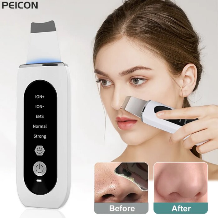 Ultrasonic Skin Scrubber Peeling Blackhead Remover Deep Face Cleaning Ultrasonic Ion Ance Pore Cleaner Facial Shovel Cleanser Beauty Tools